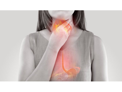 Refliuksas ir bronchitas – kas gali atsitikti supainiojus šias ligas?